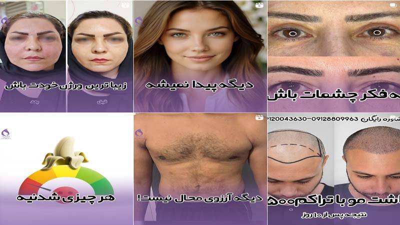 اینستاگرام کلینیک عظیمیه