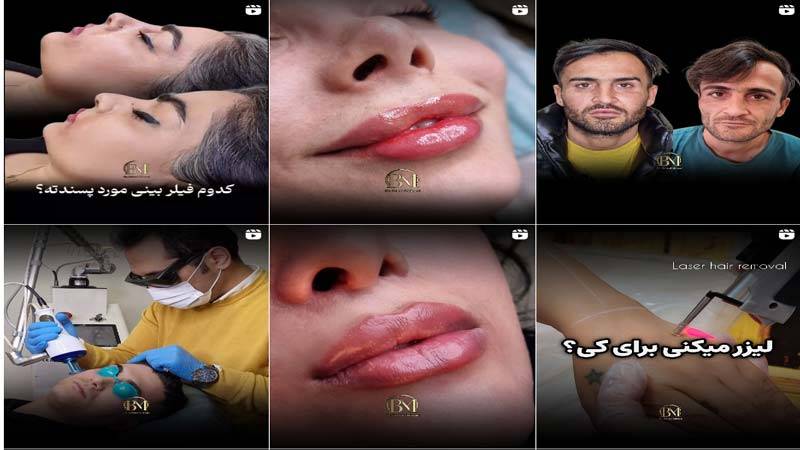 اینستاگرام کلینیک دکتر میزایی