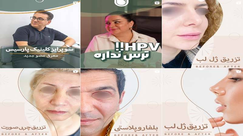 اینستاگرام کلینیک پارسيس